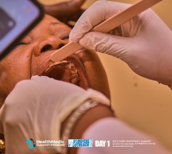 Dental Services at the HMSI Surgical Intervention Outreach
